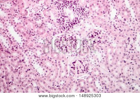 Light micrograph of a kidney showing nephron in the center of the photo. Light microscopy, hematoxylin and eosin staining, magnification 600x