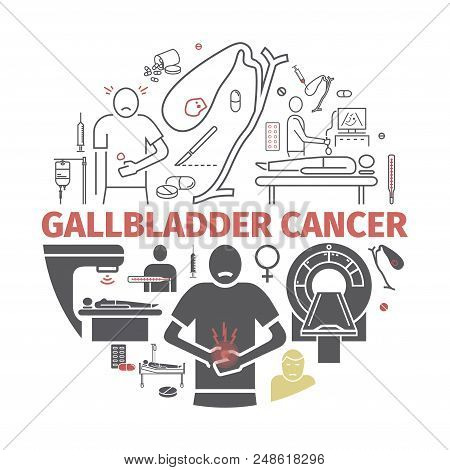 Gallbladder Cancer. Symptoms, Treatment. Line Icons Set. Vector Signs For Web Graphics