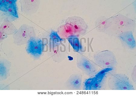 Squamous Epithelial Cells Under Microscope View For Education Histology. Human Tissue.
