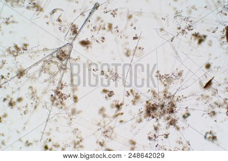 Marine Aquatic Plankton Under The Microscope View For Education.