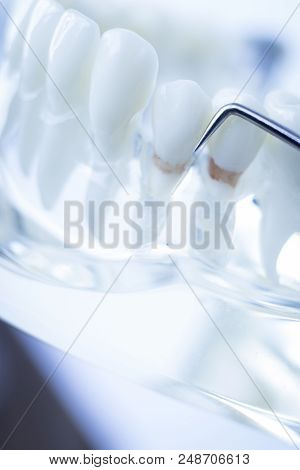 Dentist Cleaning Teeth