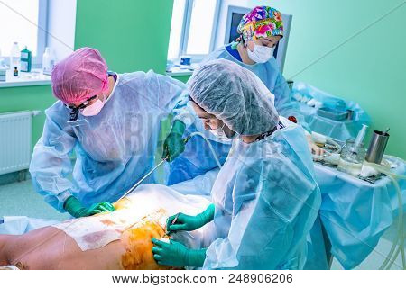 Cosmetic Liposuction Surgery In Actual Operating Room