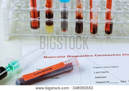 Blood Sample Corona Virus Novel Coronavirus 2019-ncov