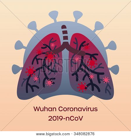 China Coronavirus Infection In Lungs. Simple Flat Illustration
