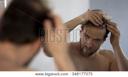 Middle-aged Man Looking In Mirror At His Bald Patches, Hair Loss Problem