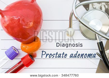 Diagnosis Of Prostate Adenoma. Medical Concept Picture Of Diagnosis Prostate Adenoma With  Anatomica