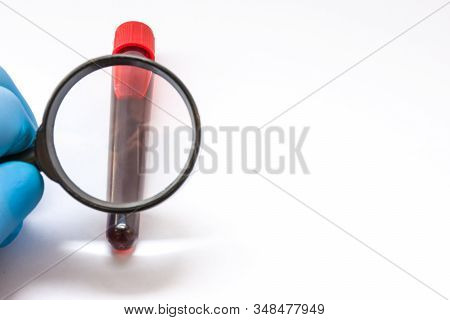 Hematology Concept Photo. Doctor Or Medical Laboratory Technician Hand In Glove Examine With Magnify