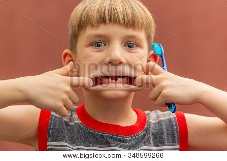 A Child With A Toothbrush In His Hand Shows A Toothless Mouth Swelling His Cheeks