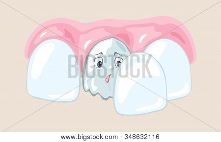 Bad Tooth Is Among Healthy Teeth. Installation Of Veneer, Implant, Whitening Procedure. Painless Sol