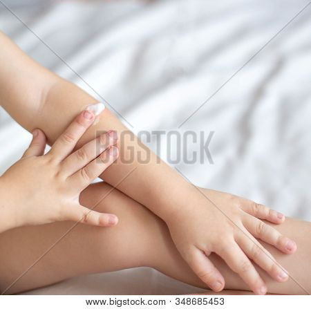 A Small Child Smears Redness On The Hand With Baby Cream. The Concept Of Treatment And Skin Care Wit