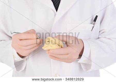 Closeup of a Dentist holding a tooth mold and using a dental pick to point to the broken tooth.