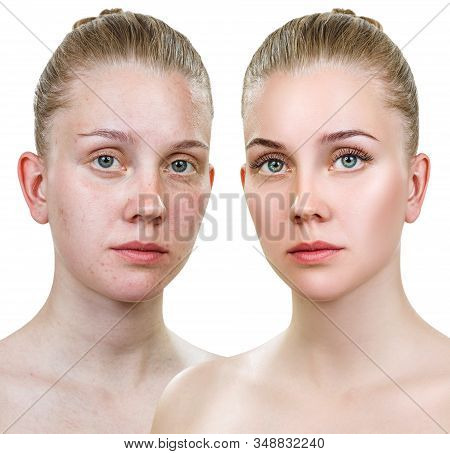 Comparison Portrait Of Young Woman With And Without Makeup. Isolated On White.