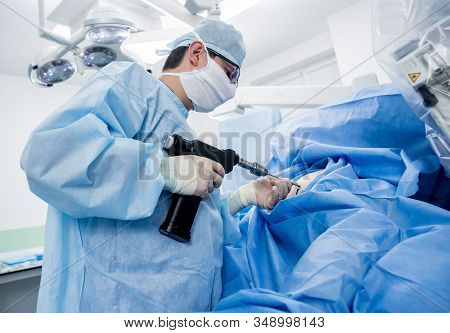 Arthroscope Surgery. Orthopedic Surgeons In Teamwork In The Operating Room