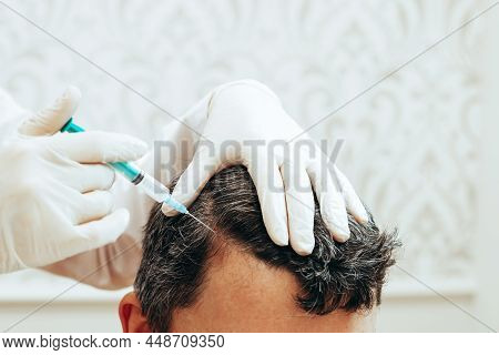 Cosmetologist Performs Anti-aging Procedures Injections Hyaluronic Acid Into Scalp, Hair Growth Prev