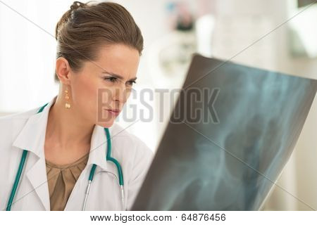 Medical Doctor Woman Looking On Fluorography