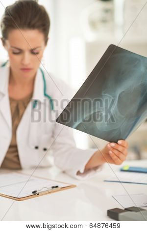 Closeup On Medical Doctor Woman With Fluorography Working In Office