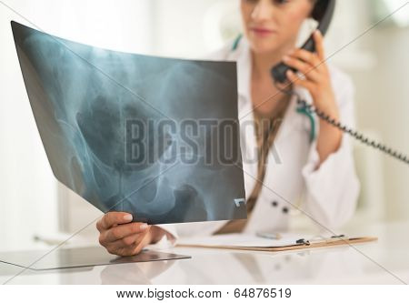 Closeup On Medical Doctor Woman Looking On Fluorography And Talk