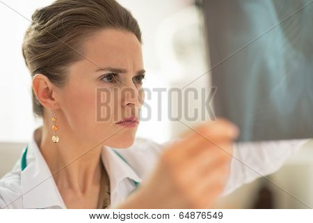 Concerned Medical Doctor Woman Looking On Fluorography