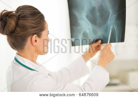 Medical Doctor Woman Pointing On Fluorography
