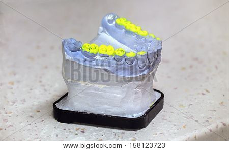 Technical shots of model on a dental prothetic laboratory