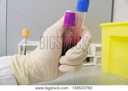 blood sampling at a private clinic in italy