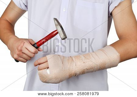 Close Up Of Young Asian Boy With Arm Plaster Fiberglass Cast Covering The Wrist Finger And Arm. Stud
