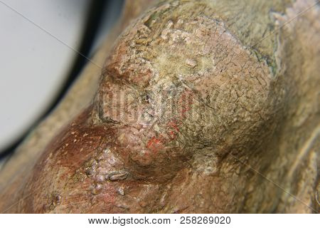 Restoration: Close Up. Conservation Of Paintings. Conservation Of Sculptures