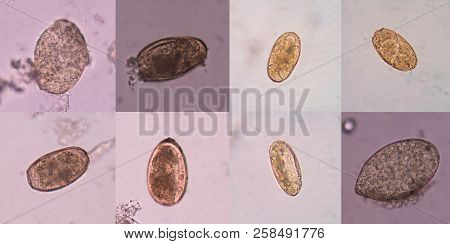 Mixed Egg Parasite In Stool Exam Medical Science Concept.