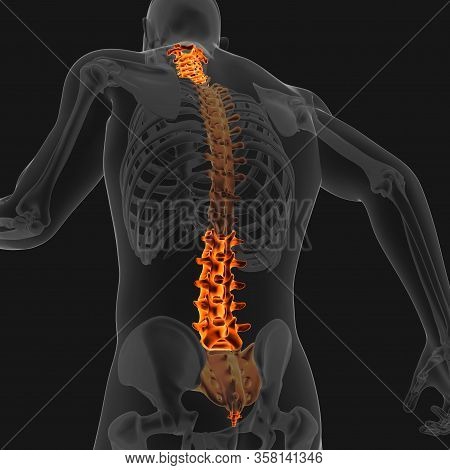 Joint Pain Can Be Caused By Injury Affecting Any Of The Ligaments, Bursae, Or Tendons Surrounding Th