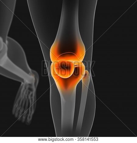 Joint Pain Can Be Caused By Injury Affecting Any Of The Ligaments, Bursae, Or Tendons Surrounding Th