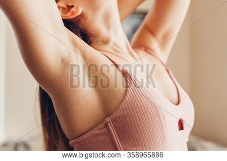 Hairy Unshaven Female Armpits. Body Positive Trend. Woman Wearing Bra Raised Arms. Acceptance Of Bod