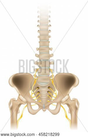 Sciatic Nerve Or Ischiadic Nerve. Medical Illustration Of The Human Spine And Pelvis. Vector