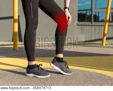 Athlete Knee Pain. Sports Trauma Caused By Patellar Fracture, Dislocation, Ligament Injury. Woman Ho