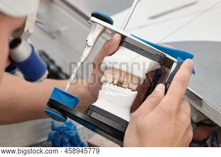Closeup Of Dental Technician's Hands Working With Articulator In Dental Laboratory