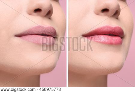 Collage With Photos Of Woman With Dry And Moisturized Lips, Closeup