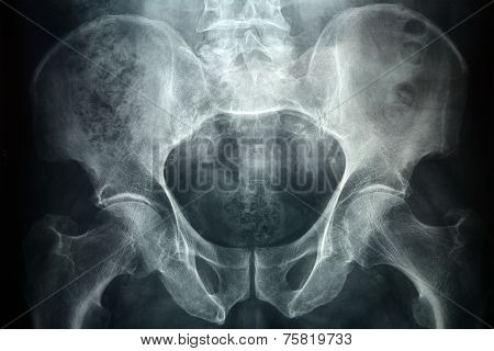 Pevic Xray