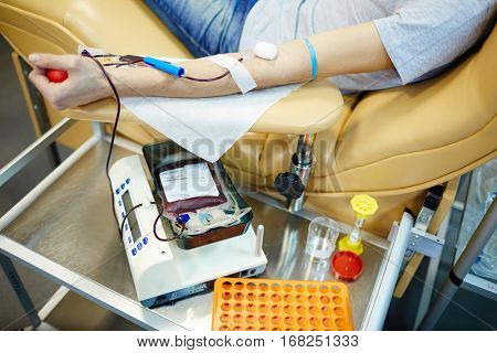 Human arm or armrest with dropper during hemotransfusion procedure