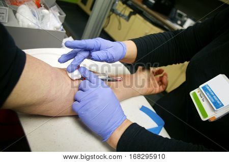 An unidentifiable person gets their blood drawn by a phlebotomist or doctor or nurse at a doctors office. Healthcare and Medical images 