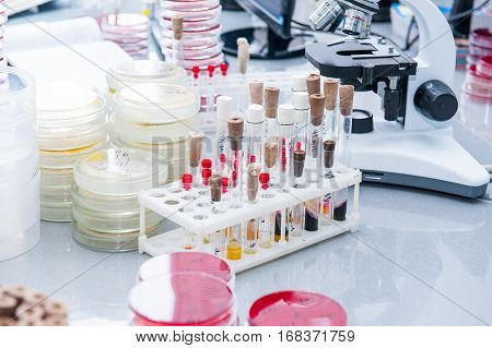 Details Of Microbiology Laboratory; Petri Dishes For Bacteria Growing, Tubes, Microscope And Oher. S