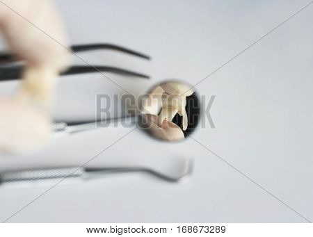 pulled out a bad tooth in the forceps of the dentist