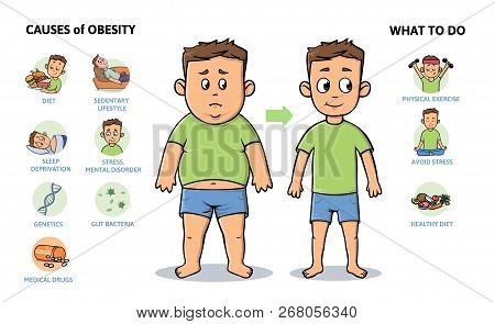 Obesity Causes And Prevention. Young Guy Before And After Diet And Fitness. Colorful Infographic Pos