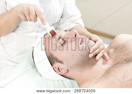 The Man Undergoes The Procedure Of Medical Micro Needle Therapy With A Modern Medical Instrument Der