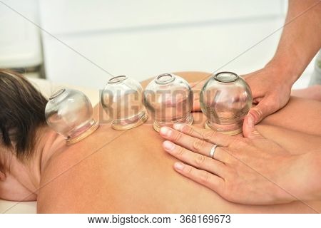 Young Female Physiotherapist Applying Glass Suction Banks On Back Of Her Patient, During Cupping The