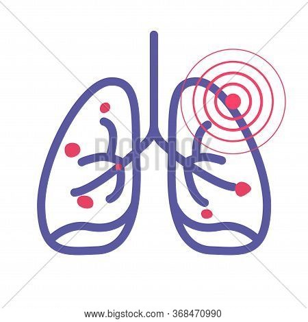 Lungs Cancer Pain Illness Or Lung Pneumonia And Bronchitis Tuberculosis Pulmonary Disease Vector Lin