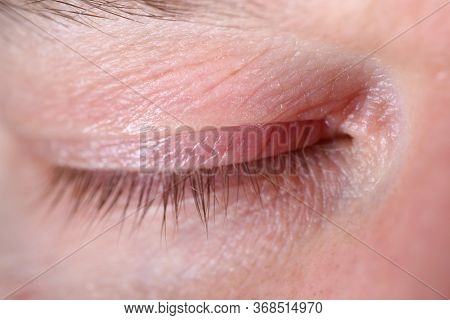 Close-up Of Middle-aged Man Closed Eye. Macro Shot Of Tiny Wrinkles On Senior Male Skin. Cant See An