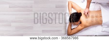Woman Receiving Suction Cup Therapy Treatment On Back