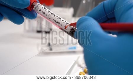 Corona Negative Blood Test. Coronavirus Covid 19 Blood Test Tube Novel Corona Virus. Syringes, Sampl