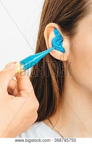 Process Of Making Earplugs From An Impression Of An Individual Human Ear. Ear Close-up. Personally M