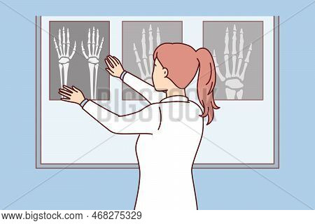 Woman Surgeon Applies X-ray Of Hand To Luminous Board To See Sites Of Bone Fracture In Patient. Girl