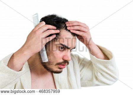 Man With Beard Worried About Hair Loss And Looking At The Mirror Of His Receding Hairline.
